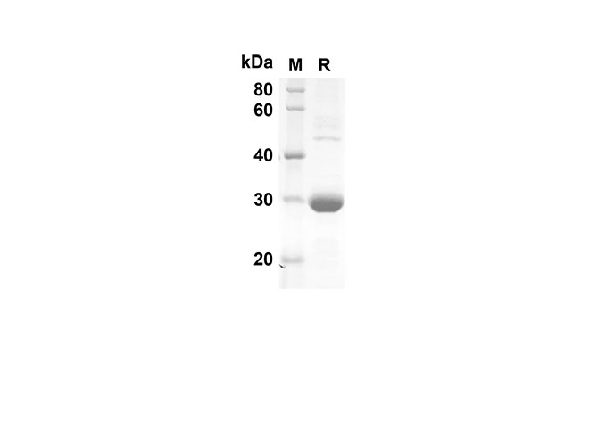 Recombinant Human CD48 Protein(His Tag)-产品推荐-1