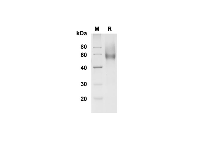 Recombinant Rat IL-17A Protein(hIgG1 Fc Tag)-产品推荐-1
