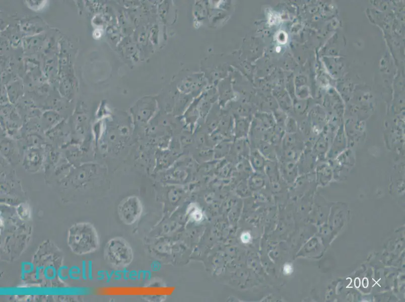 OVCAR-8 Cell Complete Medium - small - 6