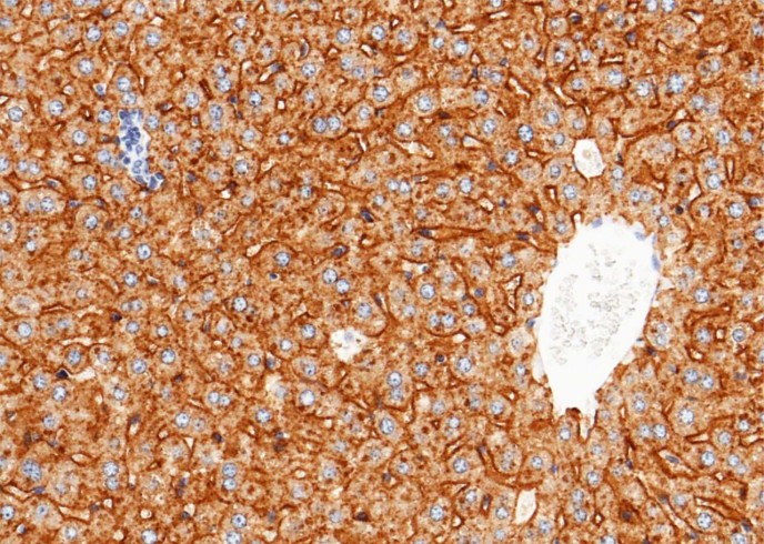 Recombinant ASGPR1/ASGR1 Monoclonal Antibody-searchlist-1