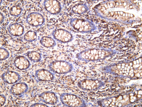 Recombinant TCTP Monoclonal Antibody - 1