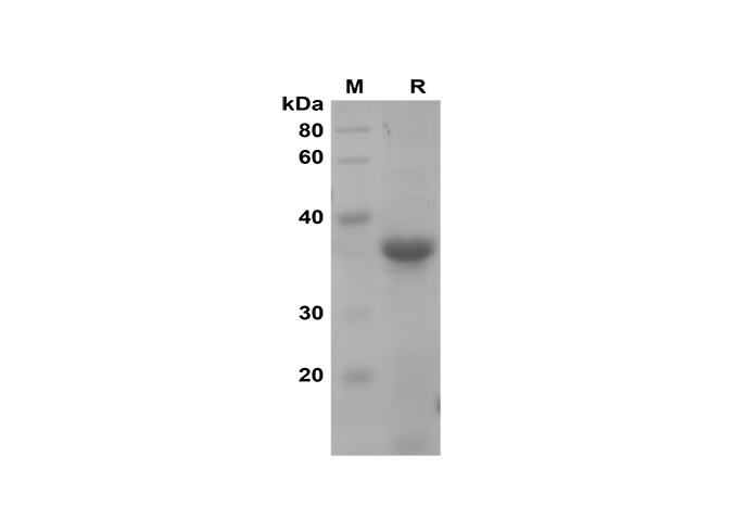 Recombinant Human IL-17A Protein(hIgG1 Fc Tag)-产品推荐-1