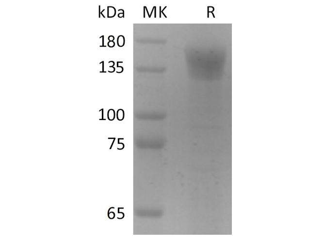 Recombinant 2019-nCoV S1 Protein (Fc Tag)
