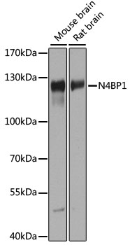 Western blot analysis of extracts of various cell lines using N4BP1 Polyclonal Antibody at 1:1000 dilution.