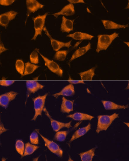 Immunofluorescence analysis of L929 cells using CAMKV Polyclonal Antibody at dilution of 1:100. Blue: DAPI for nuclear staining.