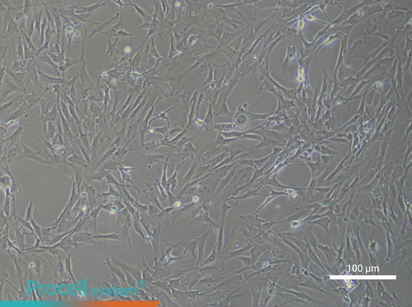 Rat Brain Microvascular Pericyte Complete Medium - 3
