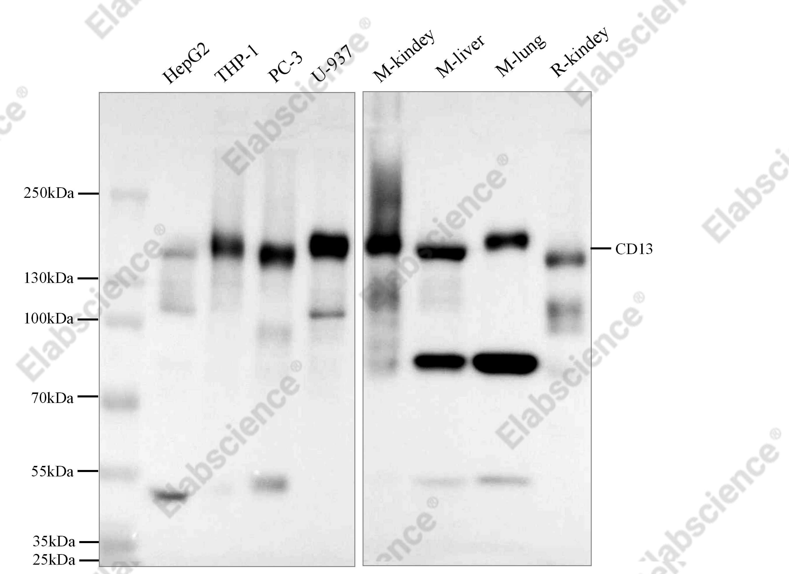 Recombinant CD13/ANPEP Monoclonal Antibody - 3