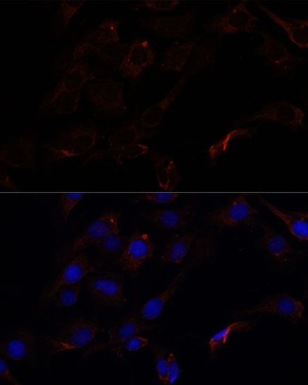 Immunofluorescence analysis of C6 cells using SEPT8 Polyclonal Antibody at dilution of  1:100. Blue: DAPI for nuclear staining.