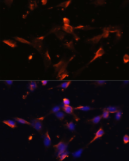 Immunofluorescence analysis of NIH/3T3 cells using CLDN5 Polyclonal Antibody at dilution of  1:100. Blue: DAPI for nuclear staining.