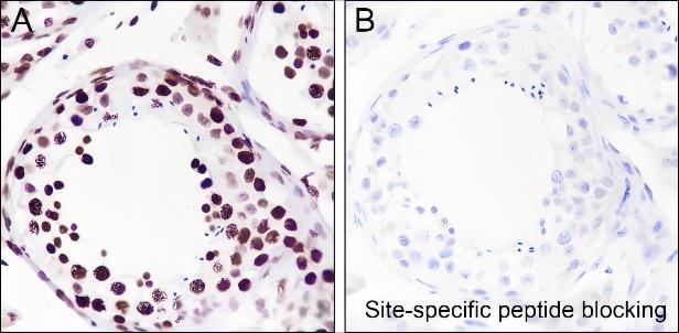 Recombinant Histone H4 (Acetyl Lys77) Monoclonal Antibody - small - 6