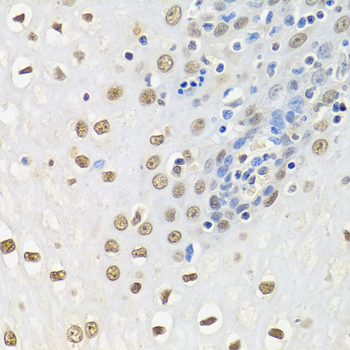 Immunohistochemistry of paraffin-embedded Human esophagus using HuR / ELAVL1 Polyclonal Antibody at dilution of  1:100 (40x lens).