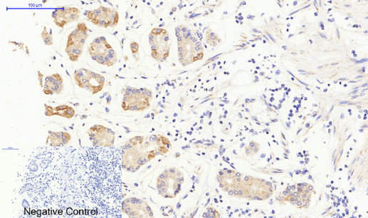 Immunohistochemistry of paraffin-embedded Human stomach tissue using JAK3 Polyclonal Antibody at dilution of 1:200.