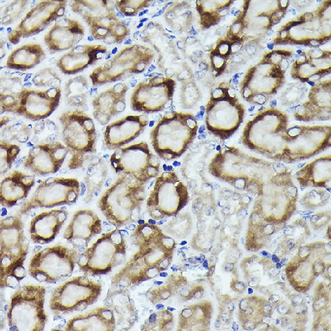 Immunohistochemistry of paraffin-embedded mouse kidney using RPL19 Polyclonal Antibody at dilution of 1:200 (40x lens).Perform high pressure antigen retrieval with 10 mM citrate buffer pH 6.0 before commencing with IHC staining protocol.