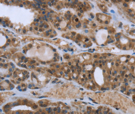 GGCX Polyclonal Antibody - 3