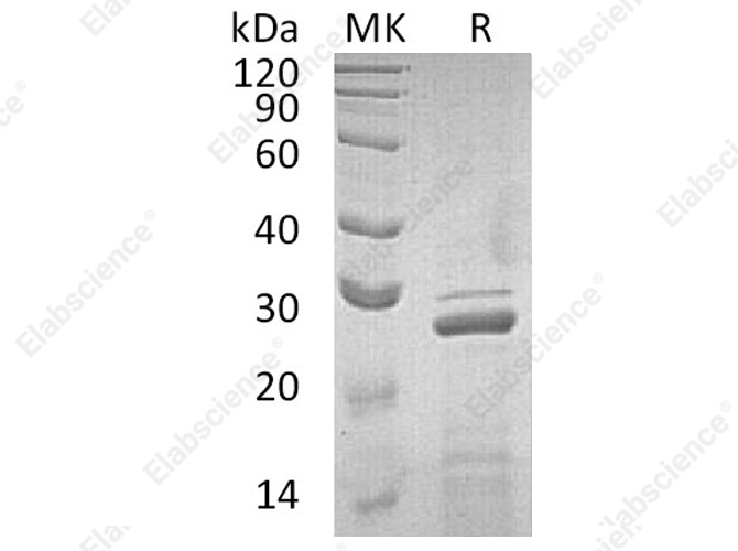 Recombinant Human Apolipoprotein A-I/ApoAI Protein - 1