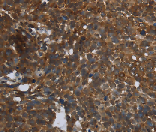 FASTKD2 Polyclonal Antibody - 3