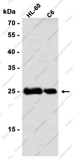 Recombinant SNAP25 Monoclonal Antibody - 1