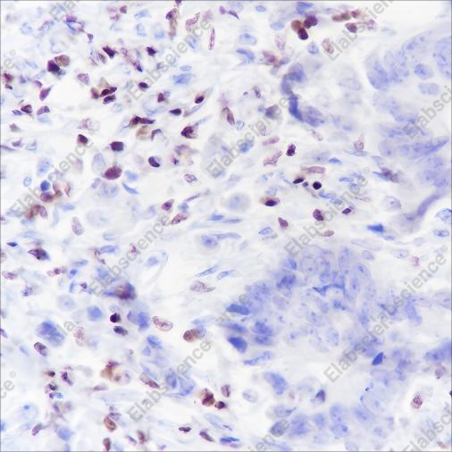 Recombinant IKAROS Monoclonal Antibody - 2