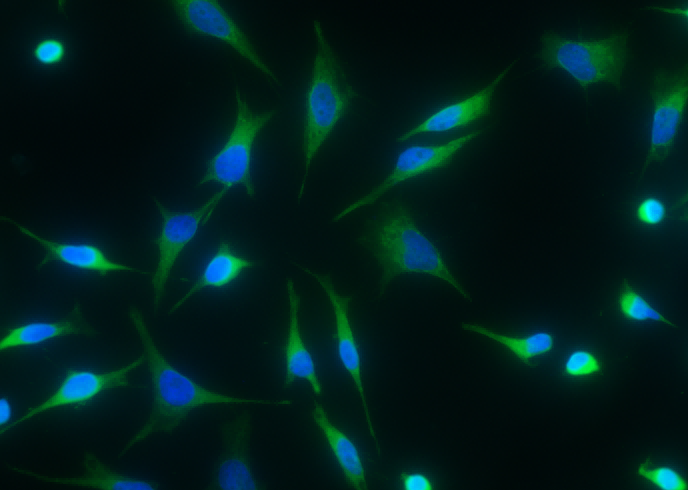 Recombinant HPGD/15-PGDH Monoclonal Antibody