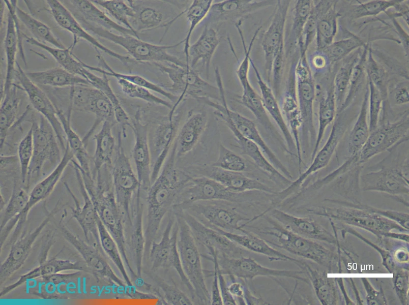 Human Synovial Fibroblast Complete Medium - 5