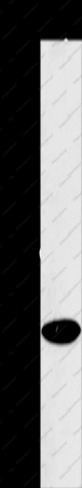 ACMSD Polyclonal Antibody - 1