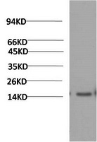 Western Blot analysis of Human serum using TTR Monoclonal Antibody at dilution of 1:2000.