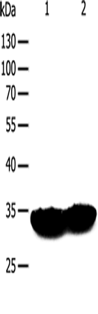 Western Blot analysis of Mouse heart and muscle tissue using TPM1 Polyclonal Antibody at dilution of 1:400