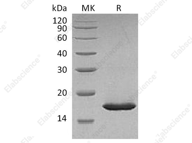 Recombinant Carassiusauratus Leptin Protein (His Tag) - 1