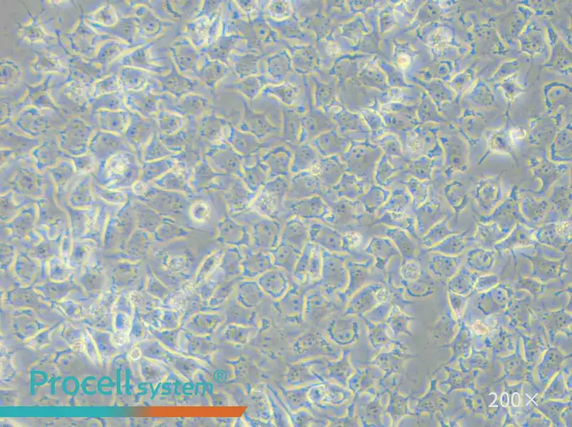 92-1 [Human uveal melanoma] Cell Complete Medium - 5