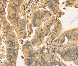 CDCA8 Polyclonal Antibody - 2