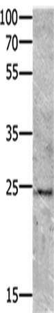 Western blot analysis of Mouse brain tissue  using VEGFB Polyclonal Antibody at dilution of 1:700