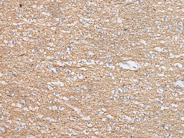 Immunohistochemistry of paraffin-embedded Human brain tissue  using IDO2 Polyclonal Antibody at dilution of 1:45(?200)