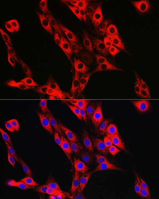 Immunofluorescence analysis of PC-12 cells using UFL1 Polyclonal Antibody at dilution of 1:50 (40x lens). Blue: DAPI for nuclear staining.