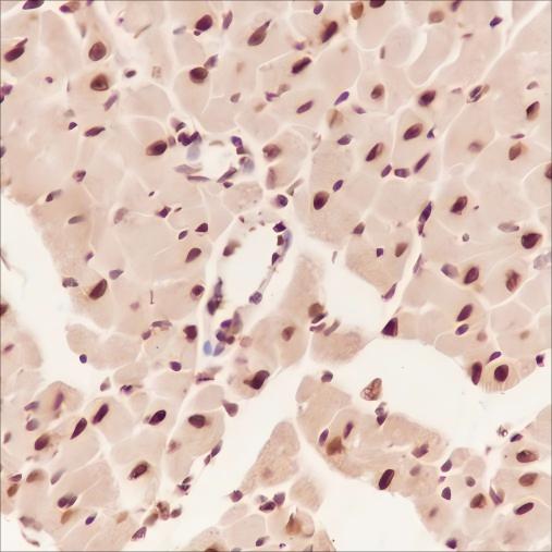 Recombinant COPS3 Monoclonal Antibody - small - 4