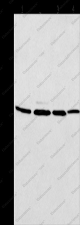 MAD2L1BP Polyclonal Antibody - 1