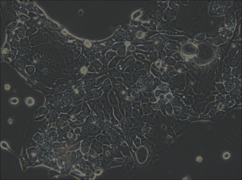 OE33 Cell Complete Medium - small - 6