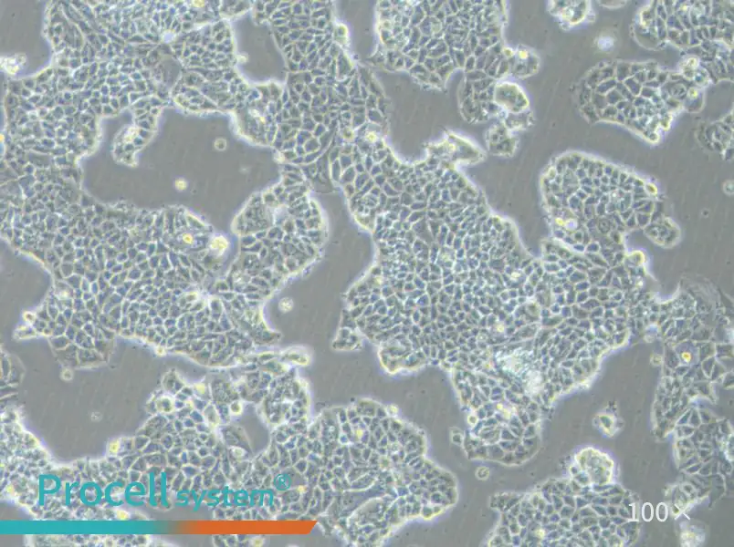 MCF-7-FLUC Cell Complete Medium - 3