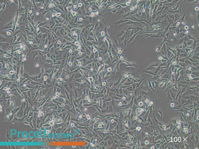 SW1573 (L15) Cell Complete Medium - 1