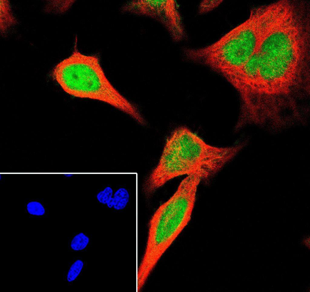 Recombinant MCM7 Monoclonal Antibody - 3