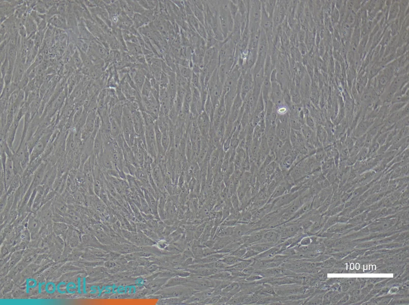 Human Cardiac Fibroblast Complete Medium - 1
