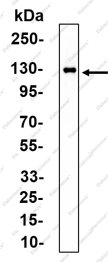 Recombinant CYLD Monoclonal Antibody - 2