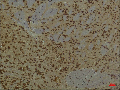 Immunohistochemistry of paraffin-embedded Mouse brain tissue using HIF1 bata Monoclonal Antibody at dilution of 1:200.