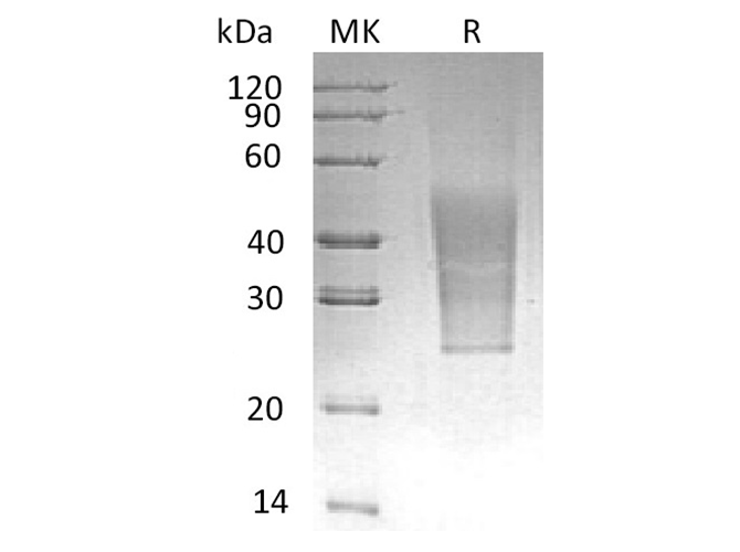 Recombinant Human CD99L2 Protein (His Tag)