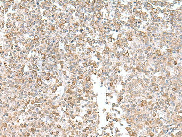 Immunohistochemistry of paraffin-embedded Human tonsil tissue  using EIF1AY Polyclonal Antibody at dilution of 1:55(?200)