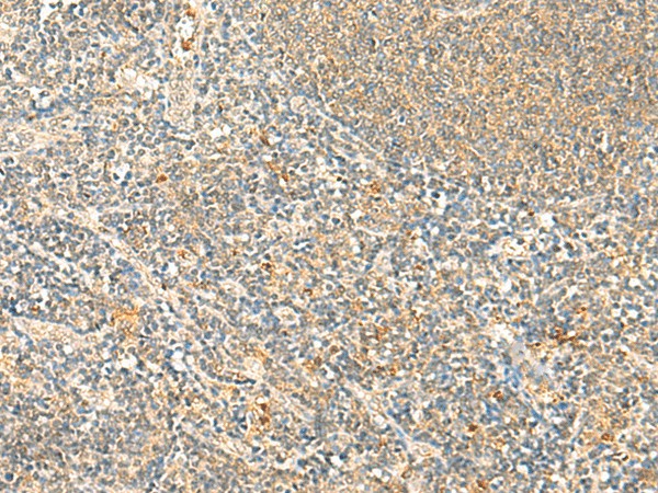 Immunohistochemistry of paraffin-embedded Human tonsil tissue  using IP6K3 Polyclonal Antibody at dilution of 1:50(?200)