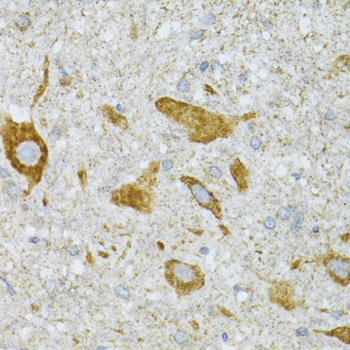 Immunohistochemistry of paraffin-embedded Mouse spinal cord using ST3GAL3 Polyclonal Antibody at dilution of 1:100 (40x lens).