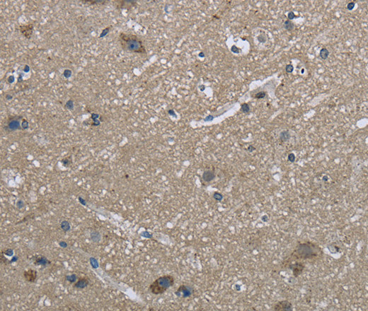 Immunohistochemistry of paraffin-embedded Human brain  using HSPA9 Polyclonal Antibody at dilution of 1:50