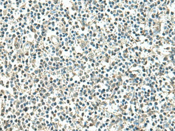 Immunohistochemistry of paraffin-embedded Human tonsil tissue  using ATP6V1C1 Polyclonal Antibody at dilution of 1:100(?200)