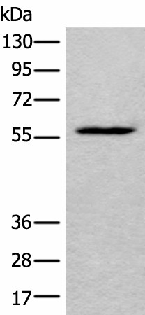 Western blot analysis of HEPG2 cell lysate  using LDHD Polyclonal Antibody at dilution of 1:400