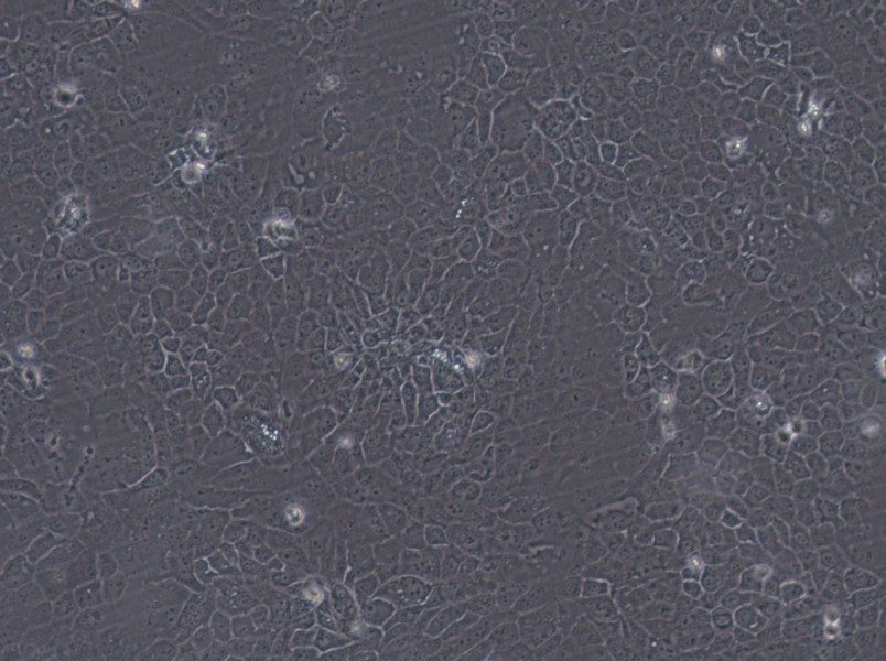 SCaBER Cell Complete Medium-searchlist-1